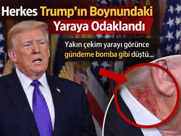 abd trump boyun yara