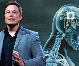 Elon Musk beyin çipi