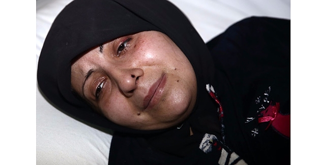 Halepli yaralı anne dehşeti anlattı