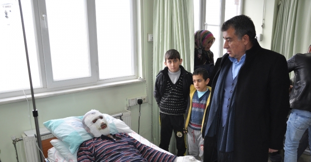 Termik santralde yangın: 3 işçi yaralandı